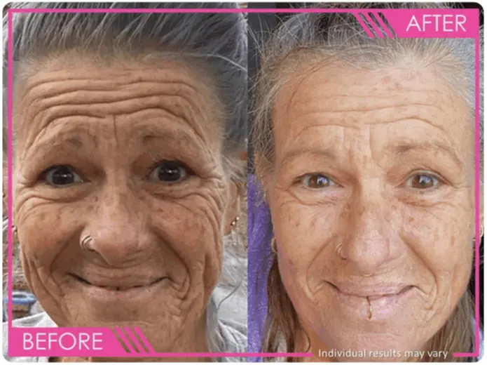 Vibriance Super C Serum